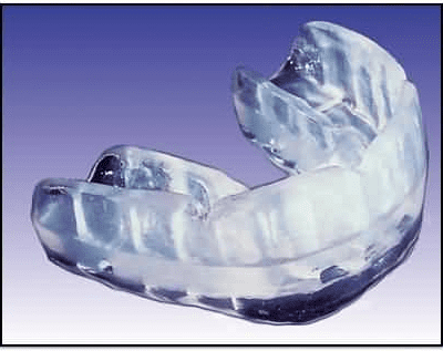 Ščitnik za zobe ''Protexsmile''