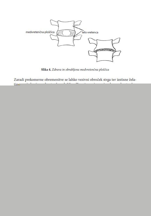 Joga za hrbtenico